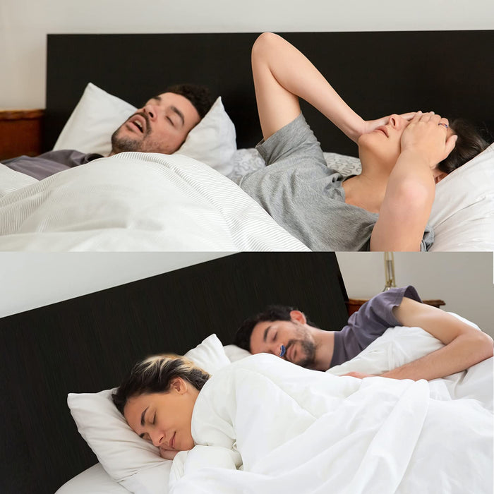 SnoreEase - Anti-Snoring Device