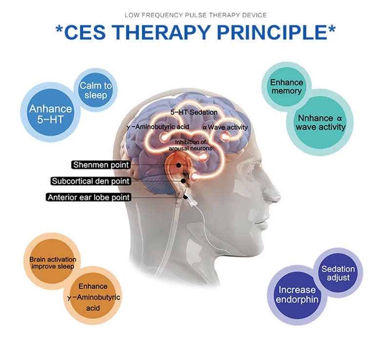 CalmMind - CES Therapy Device