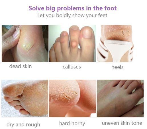 BareGlow - Exfoliating Foot Mask